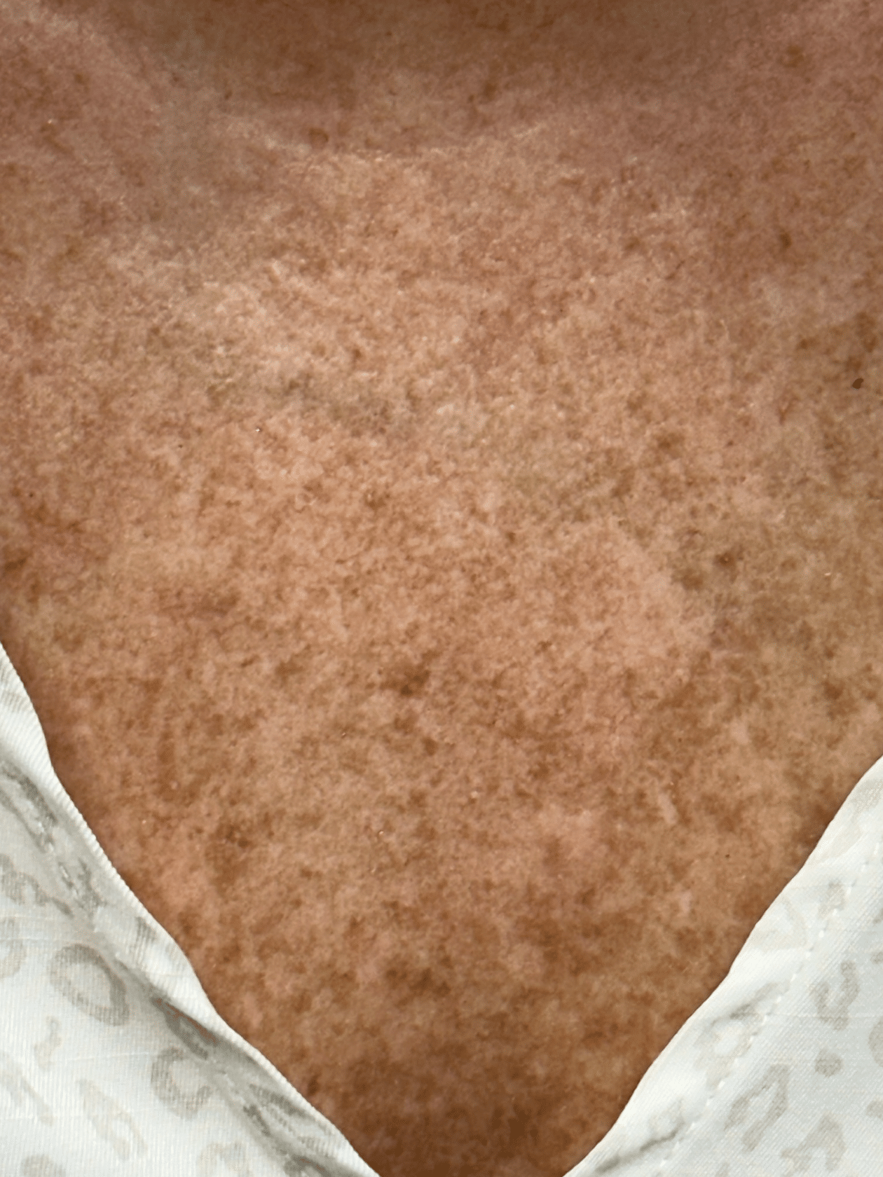 Before Image: Alpha Pro removing sunspots - front