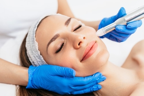 RF Microneedling in Searcy, AR